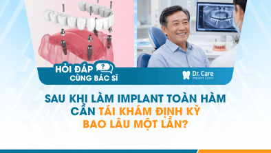 [HỎI ĐÁP BÁC SĨ]: Sau khi làm Implant toàn hàm cần tái khám định kỳ bao lâu một lần?
