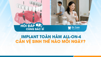 [HỎI ĐÁP BÁC SĨ]: Implant toàn hàm All-on-4 cần vệ sinh thế nào mỗi ngày? 