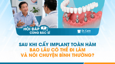 [HỎI ĐÁP BÁC SĨ]: Sau khi cấy Implant toàn hàm bao lâu có thể đi làm và nói chuyện bình thường?