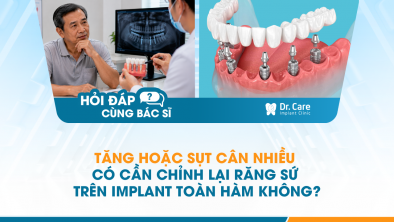 [HỎI ĐÁP BÁC SĨ]: Tăng hoặc sụt cân nhiều có cần chỉnh lại răng sứ trên Implant toàn hàm không?