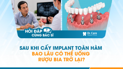 [HỎI ĐÁP BÁC SĨ]: Sau khi cấy Implant toàn hàm bao lâu có thể uống rượu bia trở lại?