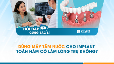 [HỎI ĐÁP BÁC SĨ]: Dùng máy tăm nước cho Implant toàn hàm có làm lỏng trụ không?