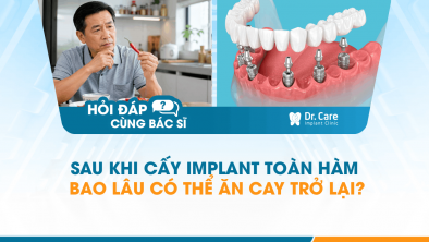 [HỎI ĐÁP BÁC SĨ]: Sau khi cấy Implant toàn hàm bao lâu có thể ăn cay trở lại?