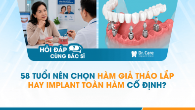 [HỎI ĐÁP BÁC SĨ]: 58 tuổi nên chọn hàm giả tháo lắp hay Implant toàn hàm cố định?