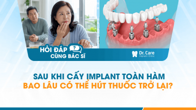 [HỎI ĐÁP BÁC SĨ]: Sau khi cấy Implant toàn hàm bao lâu có thể hút thuốc trở lại?