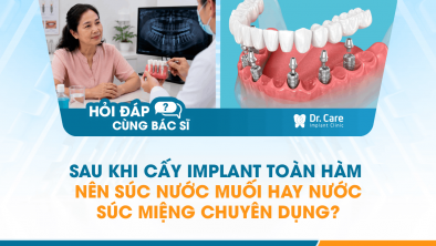 [HỎI ĐÁP BÁC SĨ]: Sau khi cấy Implant toàn hàm nên súc nước muối hay nước súc miệng chuyên dụng?
