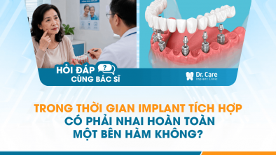 [HỎI ĐÁP BÁC SĨ]: Trong thời gian Implant tích hợp có phải nhai hoàn toàn một bên hàm không?