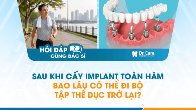 [HỎI ĐÁP BÁC SĨ]: Sau khi cấy Implant toàn hàm bao lâu có thể đi bộ tập thể dục trở lại?