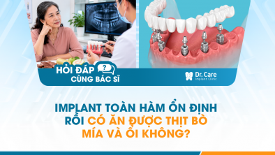[HỎI ĐÁP BÁC SĨ]: Implant toàn hàm ổn định rồi có ăn được thịt bò, mía và ổi không?