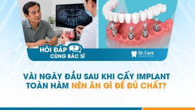 [HỎI ĐÁP BÁC SĨ]: Vài ngày đầu sau khi cấy Implant toàn hàm nên ăn gì để đủ chất?