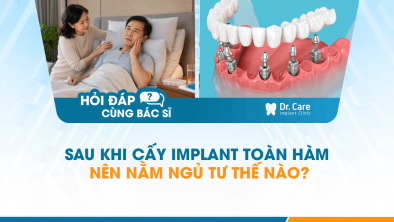 [HỎI ĐÁP BÁC SĨ]: Sau khi cấy Implant toàn hàm nên nằm ngủ tư thế nào?