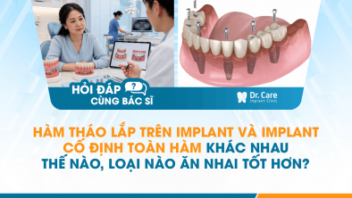 [HỎI ĐÁP BÁC SĨ]: Hàm tháo lắp trên Implant và Implant cố định toàn hàm khác nhau thế nào, loại nào ăn nhai tốt hơn?
