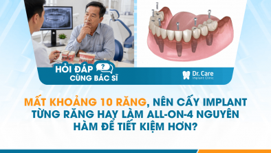 [HỎI ĐÁP BÁC SĨ]: Mất khoảng 10 răng, nên cấy Implant từng răng hay làm All-on-4 nguyên hàm để tiết kiệm hơn?