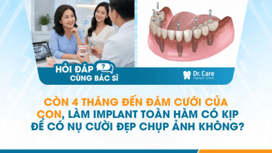 [HỎI ĐÁP BÁC SĨ]: Còn 4 tháng đến đám cưới của con, làm Implant toàn hàm có kịp để có nụ cười đẹp chụp ảnh không?