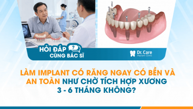 [HỎI ĐÁP BÁC SĨ]: Làm Implant có răng ngay có bền và an toàn như chờ tích hợp xương 3–6 tháng không?