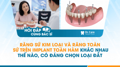 [HỎI ĐÁP BÁC SĨ]: Răng sứ kim loại và răng toàn sứ trên Implant toàn hàm khác nhau thế nào, có đáng chọn loại đắt hơn?