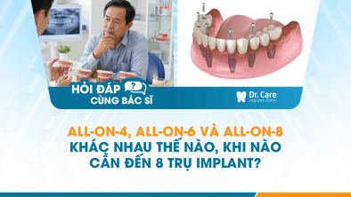 [HỎI ĐÁP BÁC SĨ]: All-on-4, All-on-6 và All-on-8 khác nhau thế nào, khi nào cần đến 8 trụ Implant?