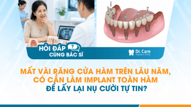 [HỎI ĐÁP BÁC SĨ]: Mất vài răng cửa hàm trên lâu năm, có cần làm Implant toàn hàm để lấy lại nụ cười tự tin?