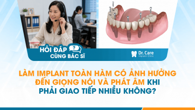 [HỎI ĐÁP BÁC SĨ]: Làm Implant toàn hàm có ảnh hưởng đến giọng nói và phát âm khi phải giao tiếp nhiều không?