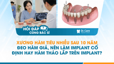 [HỎI ĐÁP BÁC SĨ]: Xương hàm tiêu nhiều sau 10 năm đeo hàm giả, nên làm Implant cố định hay hàm tháo lắp trên Implant?