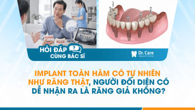 [HỎI ĐÁP BÁC SĨ]: Implant toàn hàm có tự nhiên như răng thật, người đối diện có dễ nhận ra là răng giả không?