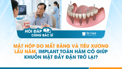 [HỎI ĐÁP BÁC SĨ]: Mặt hóp do mất răng và tiêu xương lâu năm, Implant toàn hàm có giúp khuôn mặt đầy đặn trở lại?