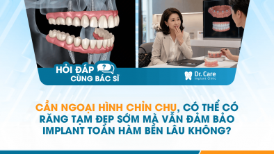 [HỎI ĐÁP BÁC SĨ]: Cần ngoại hình chỉn chu, có thể có răng tạm đẹp sớm mà vẫn đảm bảo Implant toàn hàm bền lâu không?
