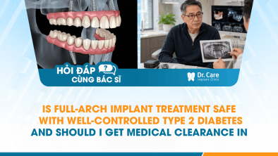 [HỎI ĐÁP BÁC SĨ]: Is Full-Arch Implant Treatment Safe with Well-Controlled Type 2 Diabetes, and Should I Get Medical Clearance in Canada First?