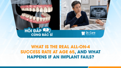 [HỎI ĐÁP BÁC SĨ]: What Is the Real All-on-4 Success Rate at Age 65, and What Happens If an Implant Fails?
