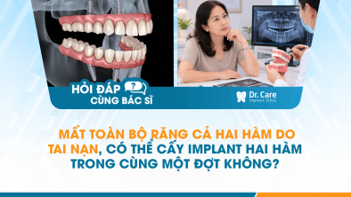 [HỎI ĐÁP BÁC SĨ]: Mất toàn bộ răng cả hai hàm do tai nạn, có thể cấy Implant hai hàm trong cùng một đợt không?