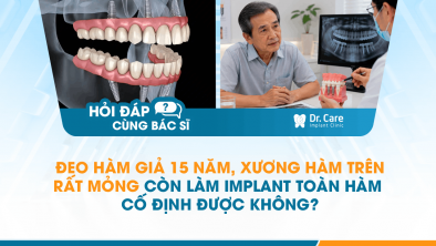 [HỎI ĐÁP BÁC SĨ]: Đeo hàm giả 15 năm, xương hàm trên rất mỏng còn làm Implant toàn hàm cố định được không?