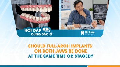 [HỎI ĐÁP BÁC SĨ]: Should Full-Arch Implants on Both Jaws Be Done at the Same Time or Staged?