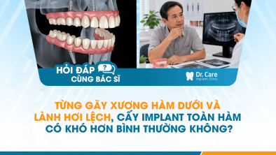 [HỎI ĐÁP BÁC SĨ]: Từng gãy xương hàm dưới và lành hơi lệch, cấy Implant toàn hàm có khó hơn bình thường không?