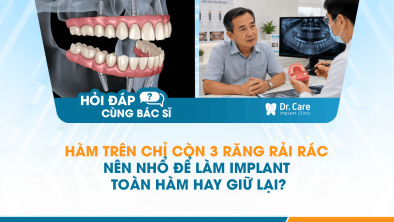 [HỎI ĐÁP BÁC SĨ]: Hàm trên chỉ còn 3 răng rải rác, nên nhổ để làm Implant toàn hàm hay giữ lại?