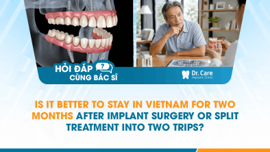 [HỎI ĐÁP BÁC SĨ]: Is It Better to Stay in Vietnam for Two Months After Implant Surgery or Split Treatment Into Two Trips?