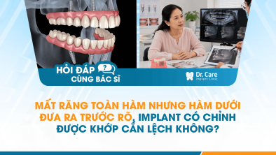 [HỎI ĐÁP BÁC SĨ]: Mất răng toàn hàm nhưng hàm dưới đưa ra trước rõ, Implant có chỉnh được khớp cắn lệch không?