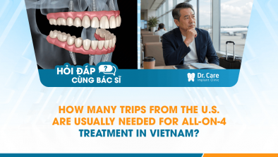 [HỎI ĐÁP BÁC SĨ]: How Many Trips from the U.S. Are Usually Needed for All-on-4 Treatment in Vietnam?