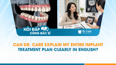 [HỎI ĐÁP BÁC SĨ]: Can Dr. Care Explain My Entire Implant Treatment Plan Clearly in English?
