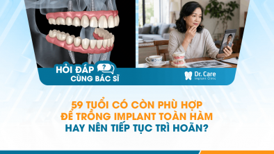 [HỎI ĐÁP BÁC SĨ]: 59 tuổi có còn phù hợp để trồng Implant toàn hàm hay nên tiếp tục trì hoãn?