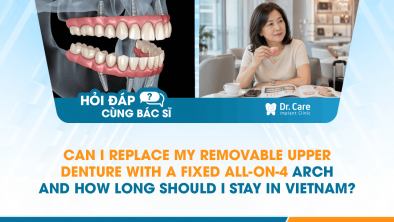 [HỎI ĐÁP BÁC SĨ]: Can I Replace My Removable Upper Denture with a Fixed All-on-4 Arch, and How Long Should I Stay in Vietnam?