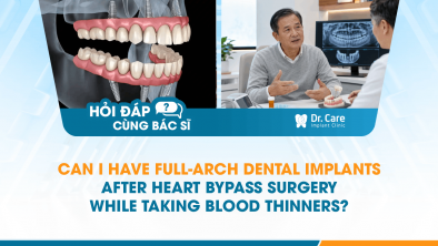 [HỎI ĐÁP BÁC SĨ]: Can I Have Full-Arch Dental Implants After Heart Bypass Surgery While Taking Blood Thinners?