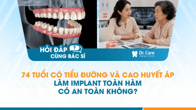 [HỎI ĐÁP BÁC SĨ]: 74 tuổi có tiểu đường và cao huyết áp, làm Implant toàn hàm có an toàn không?