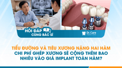 [HỎI ĐÁP BÁC SĨ]: Tiểu đường và tiêu xương nặng hai hàm, chi phí ghép xương sẽ cộng thêm bao nhiêu vào giá Implant toàn hàm?