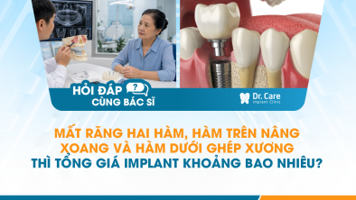 [HỎI ĐÁP BÁC SĨ]: Mất răng hai hàm, hàm trên nâng xoang và hàm dưới ghép xương thì tổng giá Implant khoảng bao nhiêu?