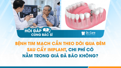[HỎI ĐÁP BÁC SĨ]: Bệnh tim mạch cần theo dõi qua đêm sau cấy Implant, chi phí có nằm trong giá đã báo không?
