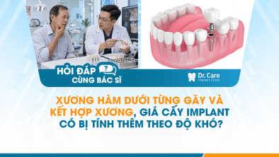 [HỎI ĐÁP BÁC SĨ]: Xương hàm dưới từng gãy và kết hợp xương, giá cấy Implant có bị tính thêm theo độ khó?