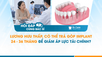 [HỎI ĐÁP BÁC SĨ]: Lương hưu thấp, có thể trả góp Implant 24–36 tháng để giảm áp lực tài chính không?