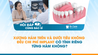 [HỎI ĐÁP BÁC SĨ]: Xương hàm trên và dưới tiêu không đều, chi phí Implant có tính riêng từng hàm không?