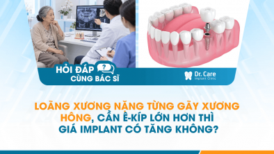 [HỎI ĐÁP BÁC SĨ]: Loãng xương nặng từng gãy xương hông, cần ê-kíp lớn hơn thì giá Implant có tăng không?