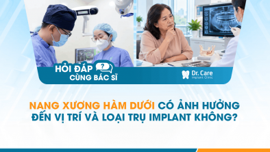[HỎI ĐÁP BÁC SĨ]: Nang xương hàm dưới có ảnh hưởng đến vị trí và loại trụ Implant không?